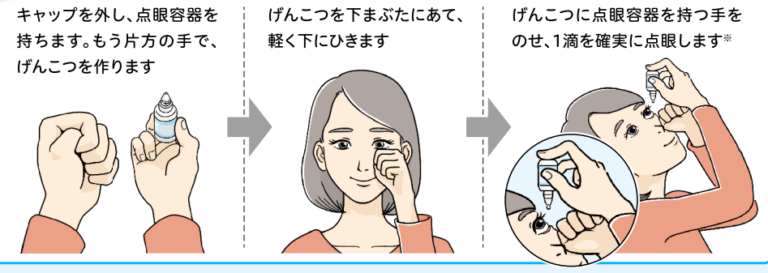 目薬のさし方 - 加納眼科